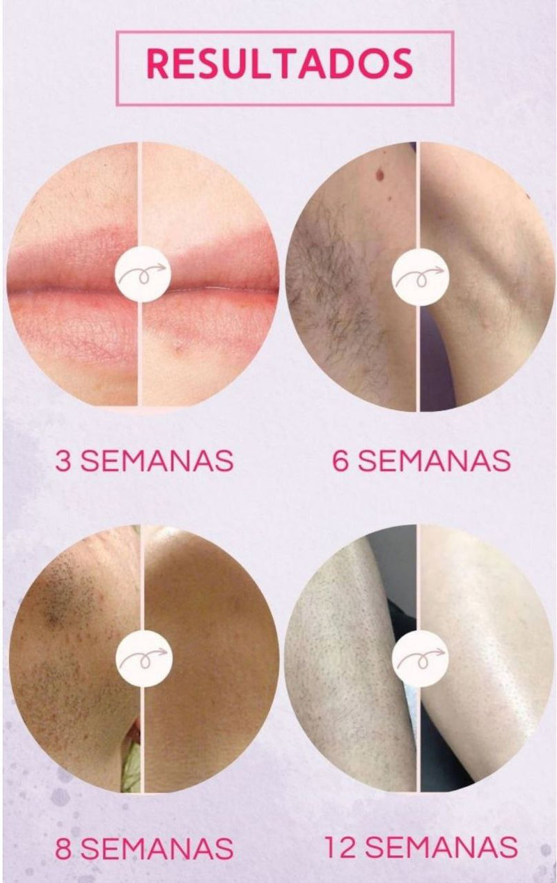 Laser de Depilação Profissional IPL, Máquina Photodepiladora, Removedor De Cabelo, Rosto, Corpo, Foto Permanente Dispositivo, Luz Pulsada